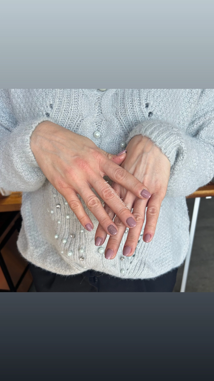 photo d'ongle