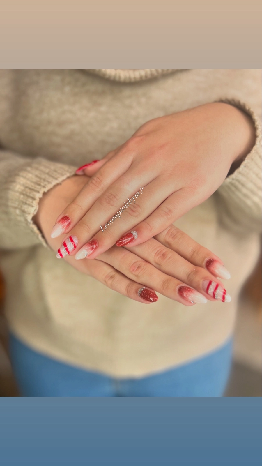 photo d'ongle
