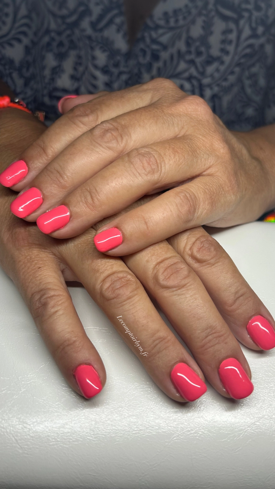photo d'ongle