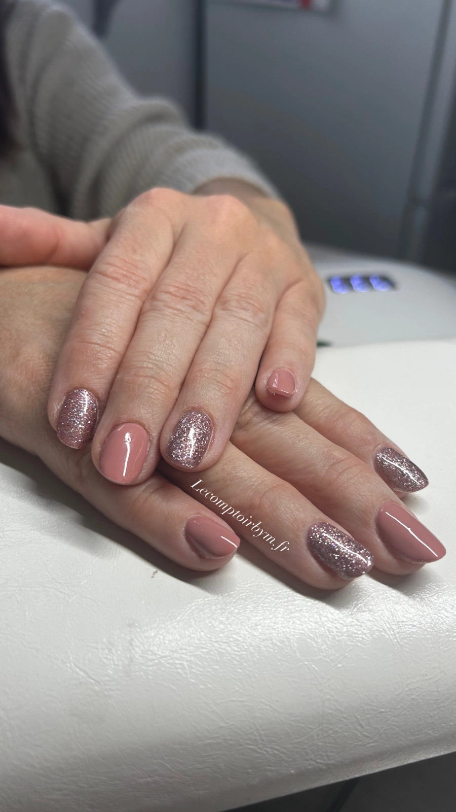 photo d'ongle