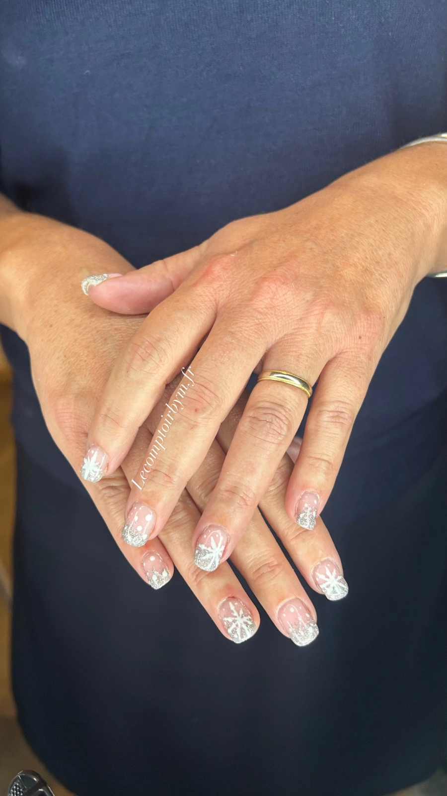 photo d'ongle