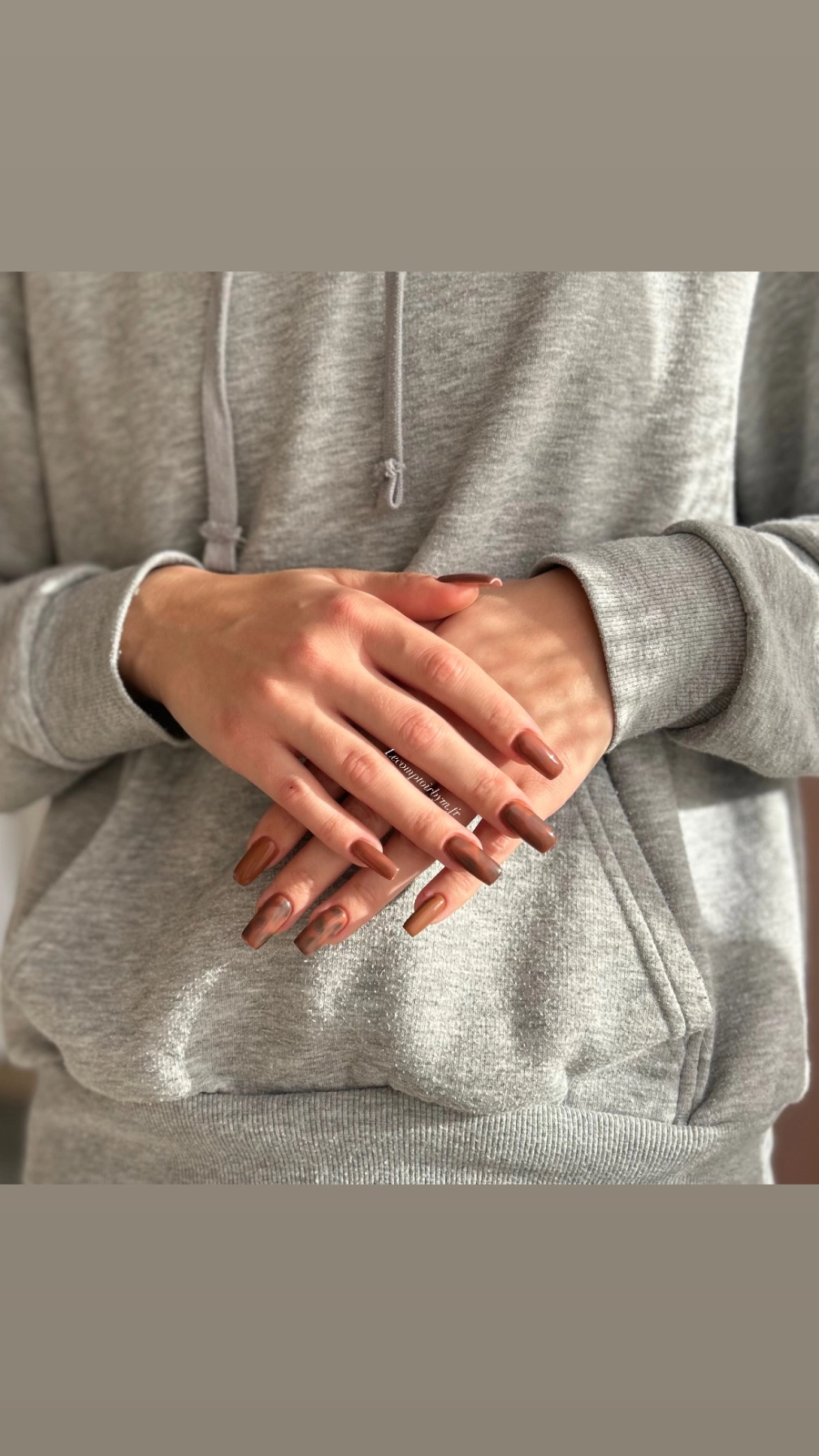 photo d'ongle